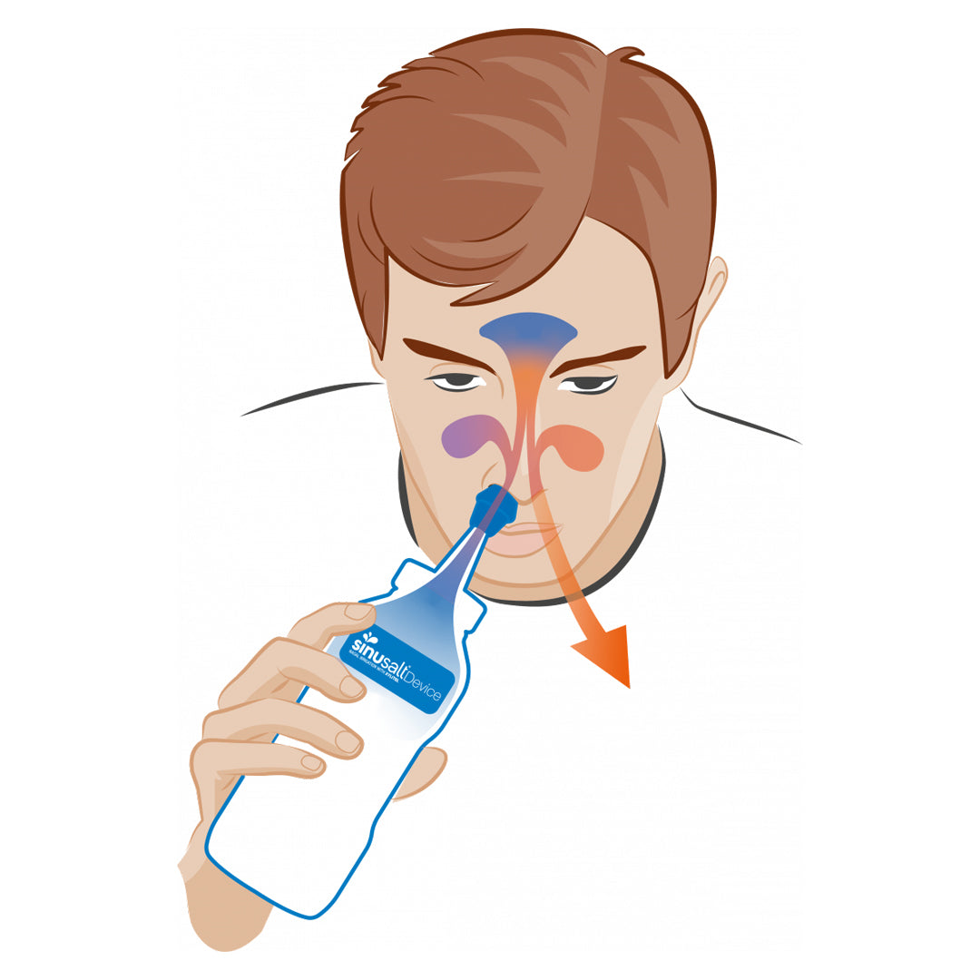 Sinu Salt Nasal Irrigation Device
